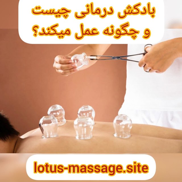 بادکش درمانی چیست و چگونه عمل میکند؟