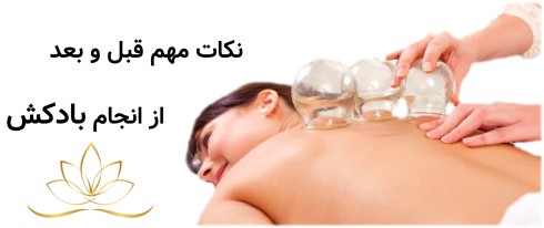 نکات مهم قبل و بعد از انجام بادکش