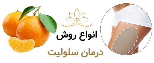 انواع روش درمان سلولیت چیست