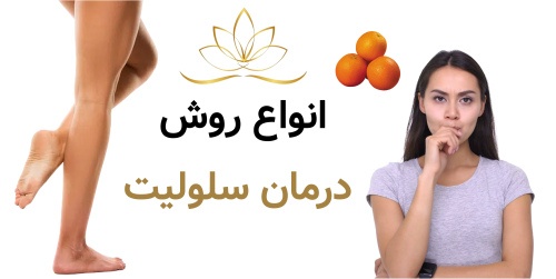 انواع روش درمان سلولیت
