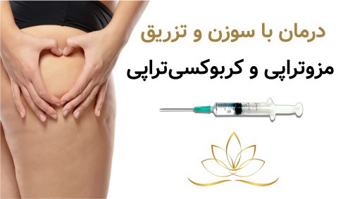 درمان با سوزن و تزریق؛ مزوتراپی و کربوکسی‌تراپی