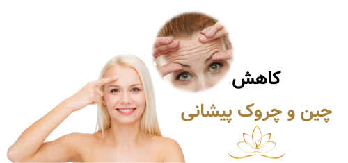 کاهش چین و چروک پیشانی