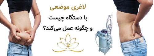 لاغری موضعی با دستگاه چیست و چگونه عمل می‌کند؟
