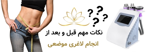 نکات مهم قبل و بعد از انجام لاغری موضعی
