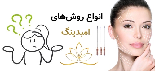 انواع روشهای امبدینگ
