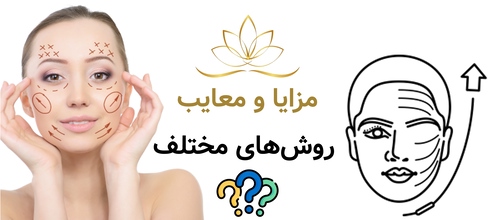 مزایا و معایب روشهای مختلف