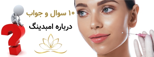 ۱۰ سوال و جواب درباره امبدینگ