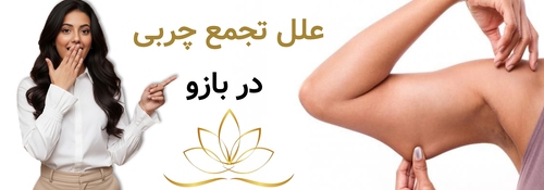 علل تجمع چربی در بازو