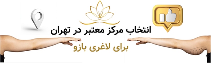 انتخاب مرکز معتبر در تهران برای لاغری بازو