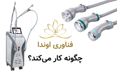 فناوری اوندا چگونه کار می‌کند؟