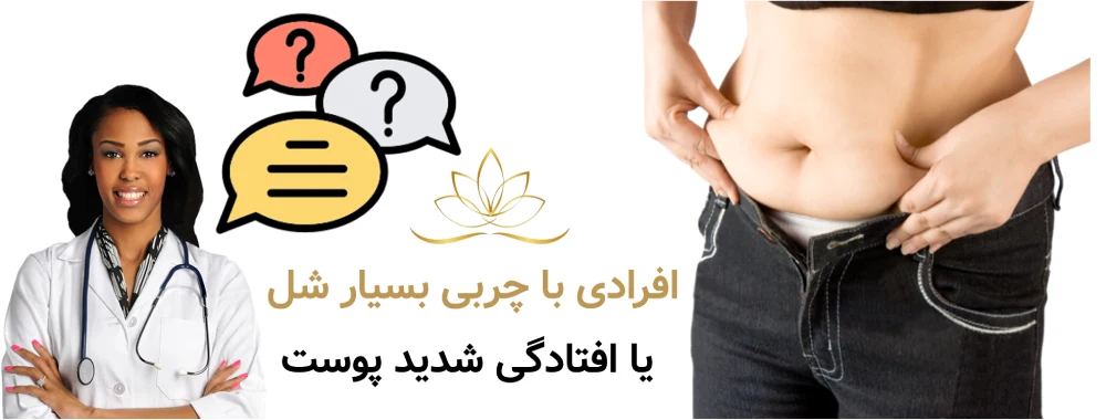 افرادی با چربی بسیار شل یا افتادگی شدید پوست