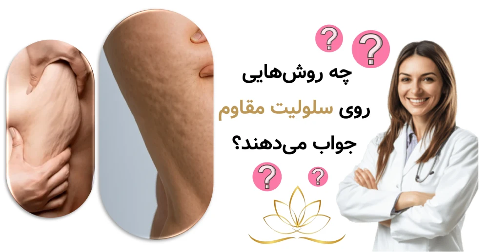 چه روش‌هایی واقعاً روی سلولیت مقاوم جواب می‌دهند؟
