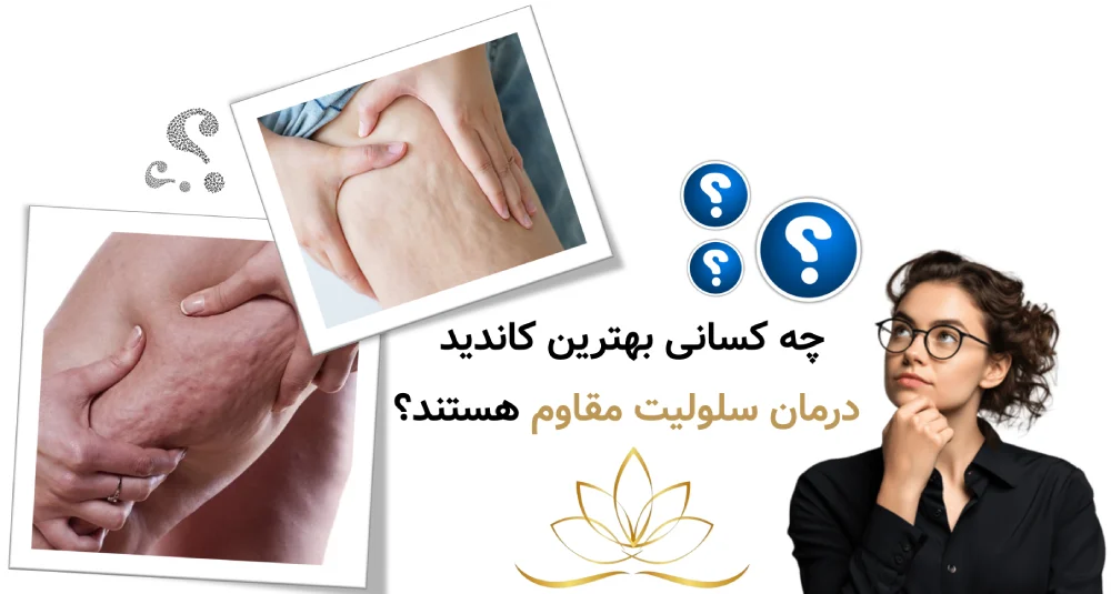 چه کسانی بهترین کاندید درمان سلولیت مقاوم هستند؟