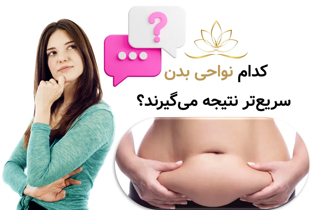 لاغری موضعی برای خانم‌های شاغل  کدام نواحی بدن سریع‌تر نتیجه می‌گیرند؟