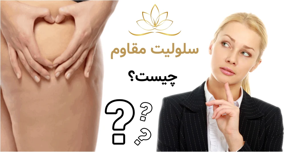 سلولیت مقاوم چیست و چه روش‌هایی واقعاً روی آن جواب می‌دهد؟