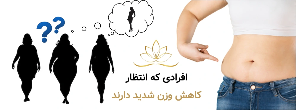 کاندید مناسبی برای جی فایو و فارادیک افرادی که انتظار کاهش وزن شدید دارند